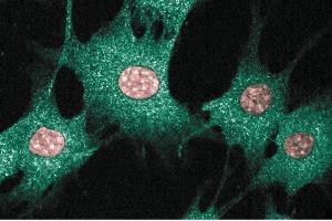 Immunofluorescence staining of BC3H1 cells (Mouse brain smooth muscle-like cells, ATCC CRL-1443). (BAX 抗体  (AA 55-178))