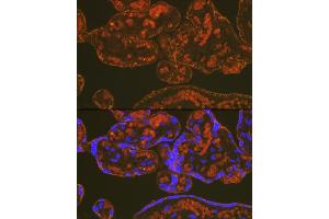 Immunofluorescence analysis of human placenta using PLGF Rabbit mAb (ABIN7269384) at dilution of 1:100 (40x lens). (PLGF 抗体)