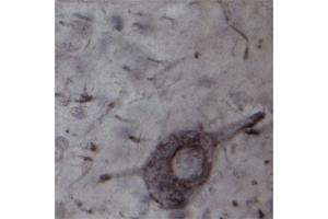 IHC on rat spinal cord (free floating sections) using Rabbit antibody to TRPC4  at a concentration of 20 µg/ml incubated overnight at room temperature with shake, developed with DAB/Ni. (TRPC4 抗体)