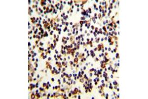 Image no. 2 for anti-Complement Component (3d/Epstein Barr Virus) Receptor 2 (CR2) (C-Term) antibody (ABIN452871)