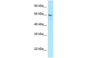 WB Suggested Anti-COL9A1 Antibody Titration: 1. (COL9A1 抗体  (N-Term))