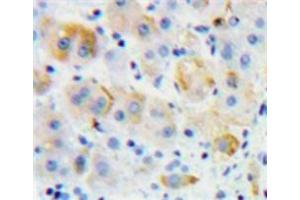 IHC-P analysis of Liver tissue, with DAB staining. (Growth Hormone Receptor 抗体  (AA 315-574))