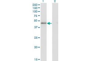 Western Blot analysis of HMG20A expression in transfected 293T cell line by HMG20A monoclonal antibody (M01), clone 4D5. (HMG20A 抗体  (AA 153-262))