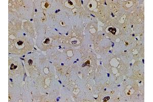 ABIN6267554 at 1/200 staining human heart tissue sections by IHC-P. (LIM Domain Kinase 1 抗体  (pThr508))