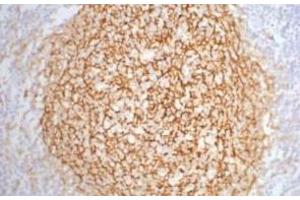 Immunohistochemistry of paraffin-embedded Human tonsil tissue using CD21 Monoclonal Antibody at dilution of 1:200. (CD21 抗体)