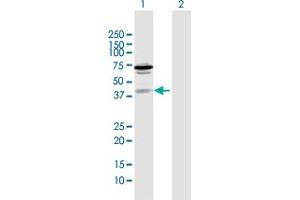 Western Blot analysis of ZNF396 expression in transfected 293T cell line by ZNF396 MaxPab polyclonal antibody. (ZNF396 抗体  (AA 1-333))