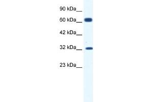 WB Suggested Anti-KCNN1 Antibody Titration:  1. (KCNN1 抗体  (C-Term))