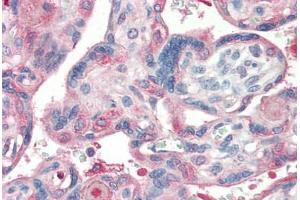 Human Placenta (formalin-fixed, paraffin-embedded) stained with Laminin antibody ABIN364494 at 5 ug/ml followed by biotinylated goat anti-rabbit IgG secondary antibody ABIN481713, alkaline phosphatase-streptavidin and chromogen. (Laminin 抗体)
