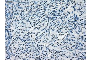 Immunohistochemical staining of paraffin-embedded endometrium tissue using anti-CRYABmouse monoclonal antibody. (CRYAB 抗体)
