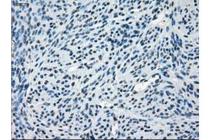 Immunohistochemical staining of paraffin-embedded endometrium tissue using anti-CRYABmouse monoclonal antibody. (CRYAB 抗体)