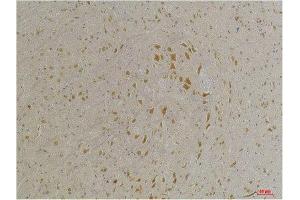 Immunohistochemistry (IHC) analysis of paraffin-embedded Mouse Brain Tissue using GABA A Receptor alpha4 Rabbit Polyclonal Antibody diluted at 1:200.
