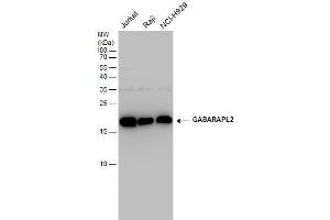 WB Image GABARAPL2 antibody detects GABARAPL2 protein by western blot analysis. (GABARAPL2 抗体  (Center))