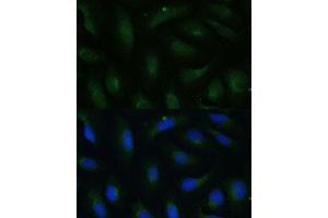 Immunofluorescence analysis of U-2 OS cells using COPG2 Polyclonal Antibody (ABIN7266426) at dilution of 1:100 (40x lens). (COPG2 抗体  (AA 542-871))