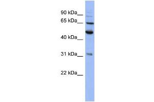Western Blotting (WB) image for anti-Proteasome (Prosome, Macropain) 26S Subunit, Non-ATPase, 3 (PSMD3) (N-Term) antibody (ABIN2786726)