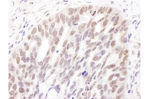 Immunohistochemistry (IHC) image for anti-DNA (Cytosine-5-)-Methyltransferase 3 alpha (DNMT3A) (AA 125-175) antibody (ABIN7454575) (DNMT3A 抗体  (AA 125-175))