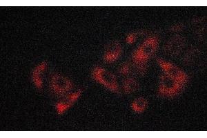 ABIN6274195 staining A549 cells by ICC/IF. (TNFRSF1B 抗体  (C-Term))