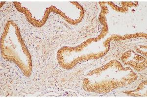 Immunohistochemistry of paraffin-embedded Human prostate gland using HRAS Polycloanl Antibody at dilution of 1:200 (HRAS 抗体)