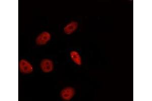 ABIN6277331 staining Hela by IF/ICC. (HSF2 抗体  (Internal Region))