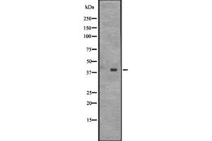 Western blot analysis of CENPL expression in HT1080 whole cell lysate ;,The lane on the left is treated with the antigen-specific peptide. (CENPL 抗体  (Internal Region))