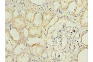 Immunohistochemistry of paraffin-embedded human kidney tissue using ABIN7173095 at dilution of 1:100 (TMEM174 抗体  (AA 94-243))