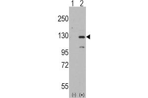 Western Blotting (WB) image for anti-Dishevelled Associated Activator of Morphogenesis 1 (DAAM1) antibody (ABIN3001578) (DAAM1 抗体)