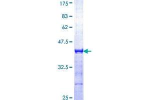 BCL6 Protein (AA 131-230) (GST tag)