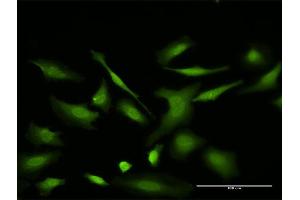 Immunofluorescence (IF) image for anti-Voltage-Dependent Anion Channel 2 (VDAC2) (AA 1-294) antibody (ABIN521316)