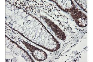 Immunohistochemical staining of paraffin-embedded Human colon tissue using anti-MCTS1 mouse monoclonal antibody. (MCTS1 抗体  (AA 1-181))