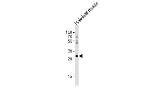 Anti-Hoxb1 Antibody (C-term) at 1:2000 dilution + human skeletal muscle lysates Lysates/proteins at 20 μg per lane. (HOXB1 抗体  (C-Term))