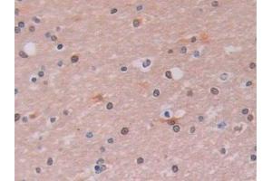 Detection of LOXL2 in Human Cerebrum Tissue using Polyclonal Antibody to Lysyl Oxidase Like Protein 2 (LOXL2) (LOXL2 抗体  (AA 544-751))