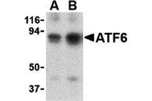 Western Blotting (WB) image for anti-Activating Transcription Factor 6 (ATF6) (N-Term) antibody (ABIN1031243) (ATF6 抗体  (N-Term))