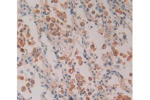 Immunohistochemistry (IHC) image for anti-Proteasome (Prosome, Macropain) 26S Subunit, Non-ATPase, 5 (PSMD5) (AA 143-341) antibody (ABIN7443182)