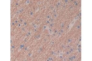 Used in DAB staining on fromalin fixed paraffin- embedded brain tissue