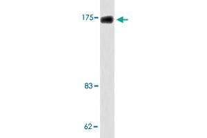 Western blot analysis of HT-29 cell lysate with TOP2A polyclonal antibody .