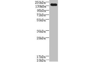 Western blot All lanes: UBE2O antibody at 0. (UBE2O 抗体  (AA 10-277))