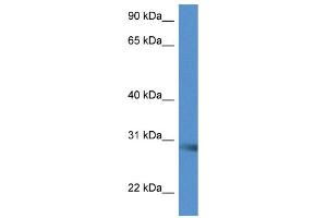 WB Suggested Anti-Scamp5 Antibody Titration: 1. (SCAMP5 抗体  (C-Term))