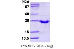 Glutathione Peroxidase 2 (GPX2) (AA 1-190), (U40C) protein (His tag)