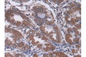 Detection of a2M in Human Stomach Tissue using Monoclonal Antibody to Alpha-2-Macroglobulin (a2M) (alpha 2 Macroglobulin 抗体  (AA 616-856))