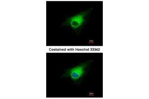 ICC/IF Image Immunofluorescence analysis of methanol-fixed A549, using PGD, antibody at 1:500 dilution. (PGD 抗体)