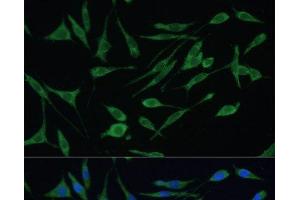 Immunofluorescence analysis of L929 cells using ARHGAP25 Polyclonal Antibody at dilution of 1:100 (40x lens). (ARHGAP25 抗体)