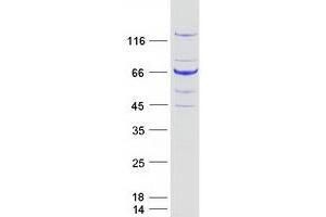 Western Blotting (WB) image for Budding Uninhibited By Benzimidazoles 1 Homolog (Yeast) (BUB1) protein (Myc-DYKDDDDK Tag) (ABIN2715360)