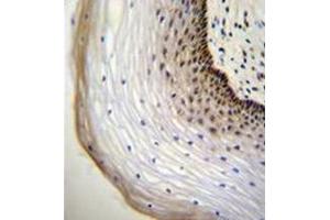 Immunohistochemistry analysis in formalin fixed and paraffin embedded human cervical tissue reacted with NUP107 Antibody (Center) followed by peroxidase conjugation of the secondary antibody and DAB staining. (NUP107 抗体  (Middle Region))