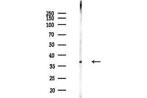 anti-Fibrillarin (FBL) (Internal Region) antibody