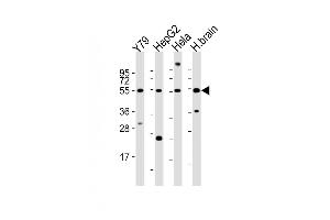 All lanes : Anti-FOXN4 Antibody (C-term) at 1:2000 dilution Lane 1: Y79 whole cell lysates Lane 2: HepG2 whole cell lysates Lane 3: Hela whole cell lysates Lane 4: human brain lysates Lysates/proteins at 20 μg per lane. (FOXN4 抗体  (C-Term))