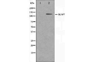 Western blot analysis on HuvEc cell lysate using SENP7 Antibody,The lane on the left is treated with the antigen-specific peptide. (SENP7 抗体  (C-Term))