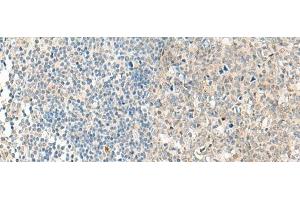 Immunohistochemistry of paraffin-embedded Human tonsil tissue using NPBWR1 Polyclonal Antibody at dilution of 1:50(x200) (NPBWR1 抗体)