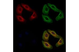 ABIN7093916 and ABIN7097960 staining Hela cells by IF/ICC. (MGAT1 抗体  (C-Term))