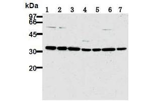 Western Blotting (WB) image for anti-Cyclin-Dependent Kinase 2 (CDK2) antibody (ABIN1106646) (CDK2 抗体)