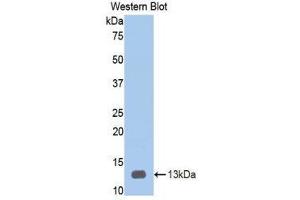 Western Blotting (WB) image for anti-Heparanase (HPSE) (AA 34-115) antibody (ABIN1859190) (HPSE 抗体  (AA 34-115))
