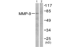Western Blotting (WB) image for anti-Matrix Metallopeptidase 9 (Gelatinase B, 92kDa Gelatinase, 92kDa Type IV Collagenase) (MMP9) (C-Term) antibody (ABIN1848693) (MMP 9 抗体  (C-Term))